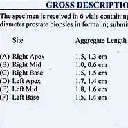 elements of a prostate biopsy report combine with prostate size measurements